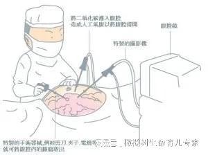 输卵管腹腔镜手术视频,输卵管腹腔镜手术操作步骤及技巧解析