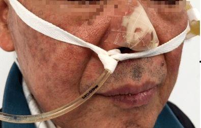 鼻试管操作视频,轻松掌握鼻腔护理技巧